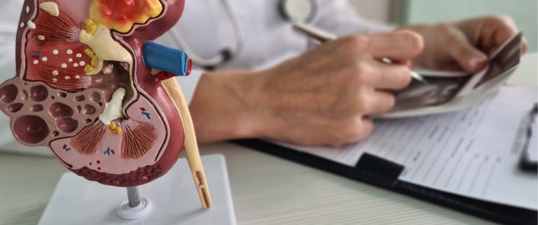 Understanding Prostate Cancer: Symptoms and Signs