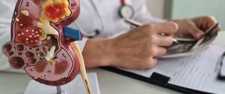 The Early Signs and Symptoms of Chronic Kidney Disease